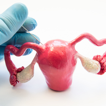 Биопсия эндометрии матки