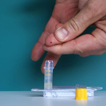 Анализ на совместимость для зачатия